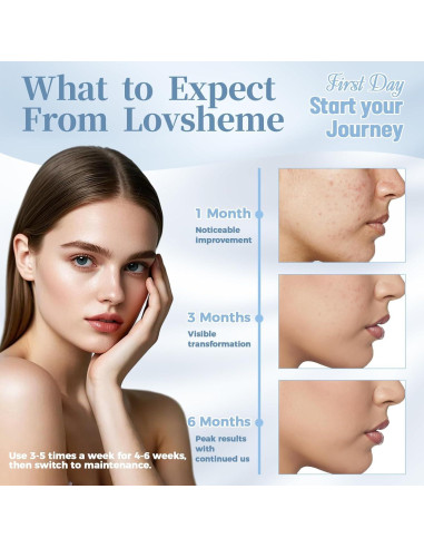 Máscara de Terapia de Luz Roja Lovsheme - Rejuvenecimiento Facial