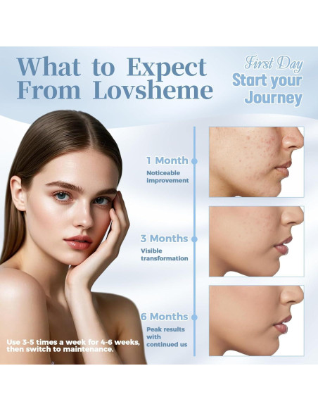 Máscara de Terapia de Luz Roja Lovsheme - Rejuvenecimiento Facial Máscara de Terapia de Luz Roja Lovsheme - Rejuvenecimiento Facial