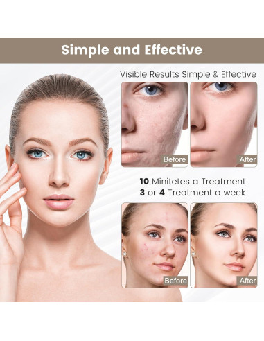 Máscara Facial de Luz LED 7 Colores - Cuidado de Piel