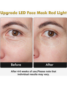 Máscara de Terapia de Luz LED 7 Colores Mhpoycd para Cara y Cuello 2