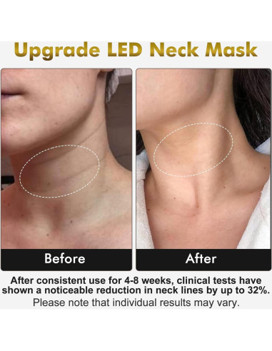 Máscara de Terapia de Luz LED 7 Colores Mhpoycd para Cara y Cuello