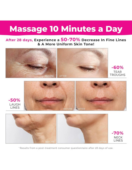 Masajeador Facial de Luz Roja Biidey 7 en 1 Cuidado Piel Masajeador Facial de Luz Roja Biidey 7 en 1 Cuidado Piel