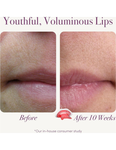 Dispositivo de Terapia de Luz Roja reVive Lux para Labios Dispositivo de Terapia de Luz Roja reVive Lux para Labios