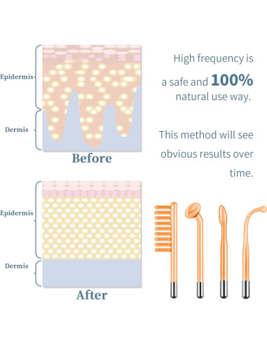 Máquina Facial de Alta Frecuencia TUMAKOU Portátil 4 Tubos