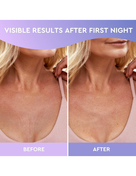 Parches de Silicona para Arrugas en el Escote CLEVERFY - 4 Parches Reutilizables Parches de Silicona para Arrugas en el Escote CLEVERFY - 4 Parches Reutilizables