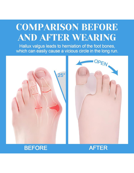 Paquete de 6 Protectores de Gel para Juanetes Nailgelicer Paquete de 6 Protectores de Gel para Juanetes Nailgelicer