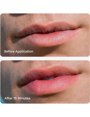 Brillo Labial Mate Chaddy - Hidratante Voluminizador 15ml