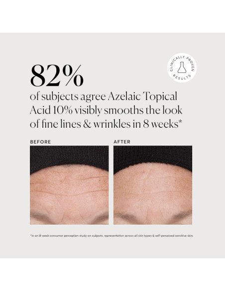 Naturium Ácido Tópico Azelaico 10% con Niacinamida 28.35 g Naturium Ácido Tópico Azelaico 10% con Niacinamida 28.35 g