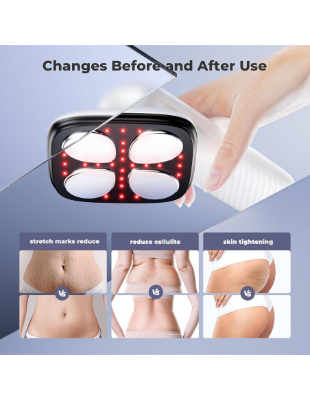 Masajeador de Celulitis Depsoul Inalámbrico para Cuerpo Masajeador de Celulitis Depsoul Inalámbrico para Cuerpo