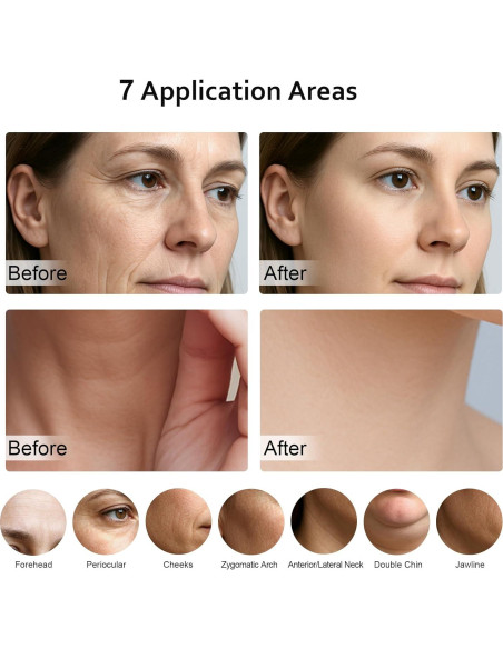 Masajeador Facial Multifuncional Keylitos 5 en 1 Rosa Masajeador Facial Multifuncional Keylitos 5 en 1 Rosa