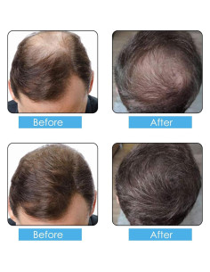 Spray de Fibras para Cabello Aliver 100g Marrón Medio 2