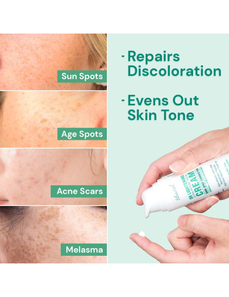 Crema Despigmentante Ebanel 42g para Manchas Oscuras Crema Despigmentante Ebanel 42g para Manchas Oscuras