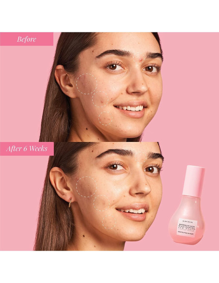 Suero Facial Glow Recipe Niacinamide 40ml - Hidratante Iluminador Suero Facial Glow Recipe Niacinamide 40ml - Hidratante Iluminador