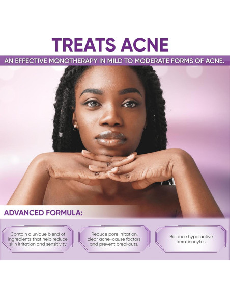 Crema Tratamiento Acné AOBBIY Ácido Azelaico 10% 28g Crema Tratamiento Acné AOBBIY Ácido Azelaico 10% 28g